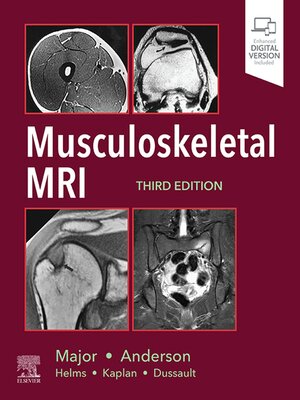 cover image of Musculoskeletal MRI E-Book